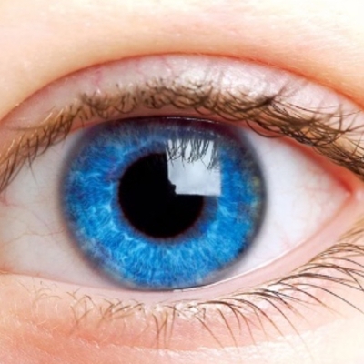 Arya eye clinic